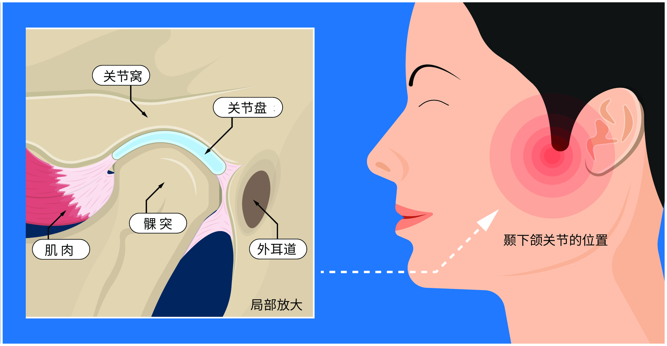 颞下颌关节