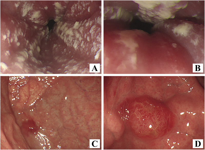 图片预览